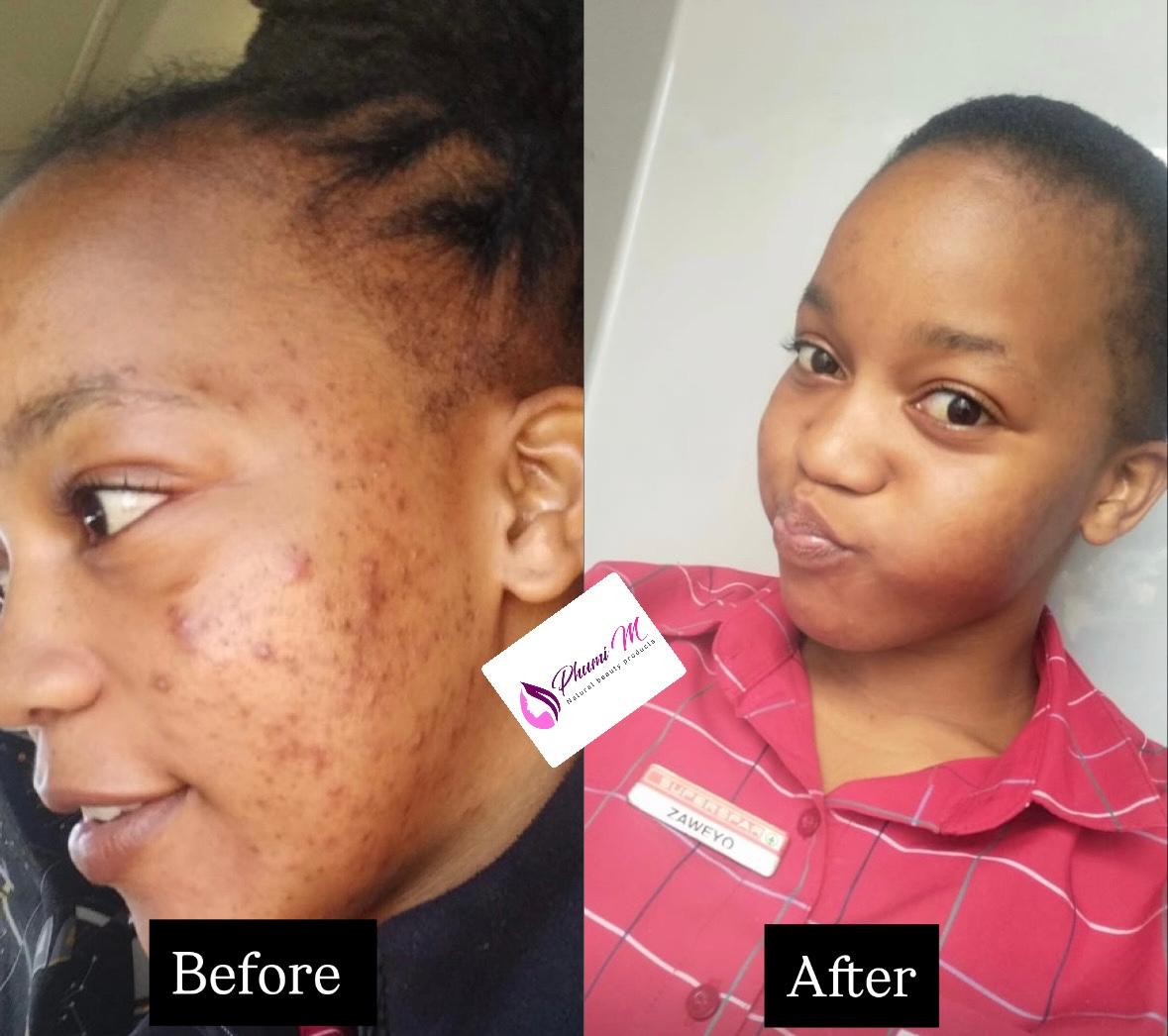 Face-care routine — before & after