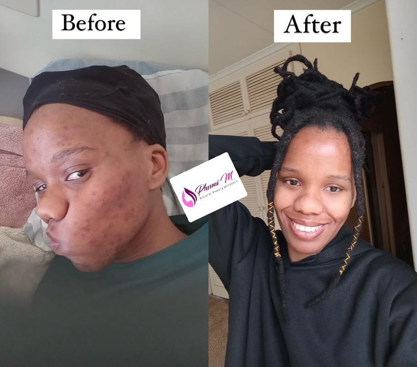 Face-care routine — clearer, calmer skin